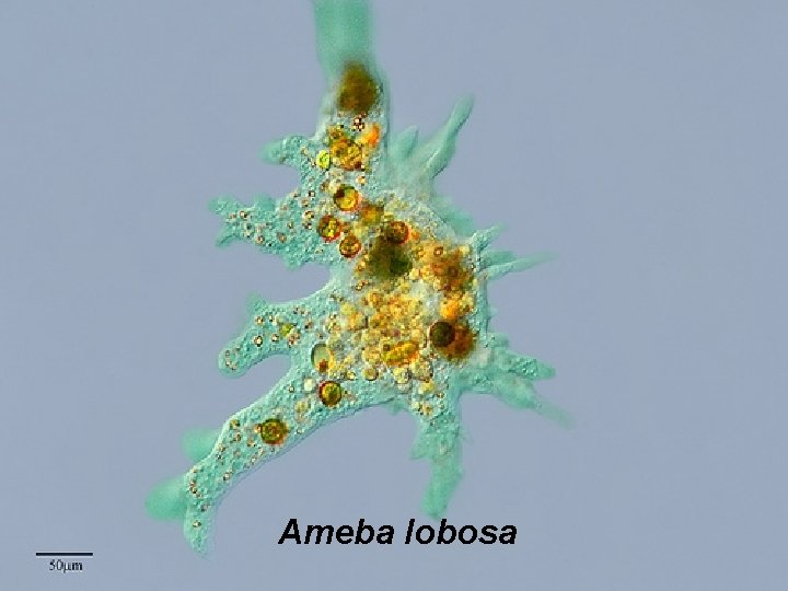 Ameba lobosa 