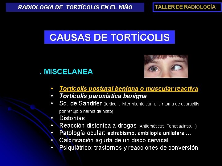 RADIOLOGIA DE TORTÍCOLIS EN EL NIÑO TALLER DE RADIOLOGÍA CAUSAS DE TORTÍCOLIS. MISCELANEA •