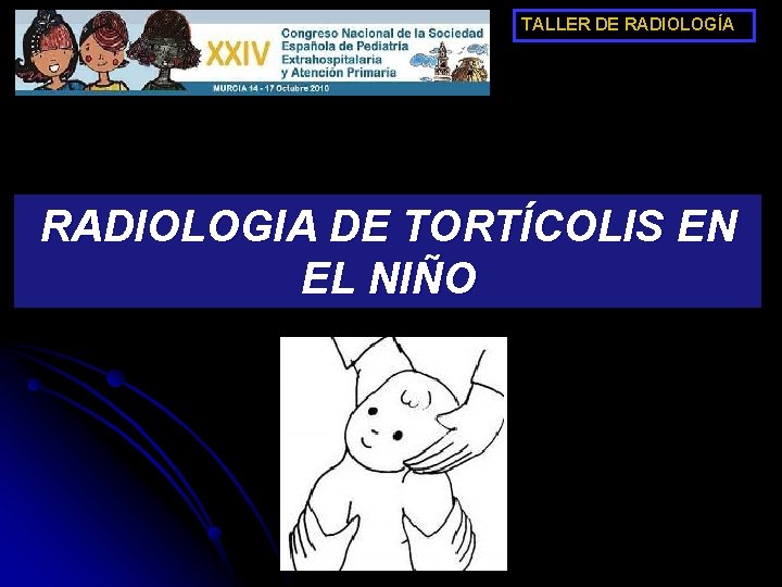 TALLER DE RADIOLOGÍA RADIOLOGIA DE TORTÍCOLIS EN EL NIÑO 