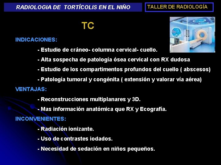 RADIOLOGIA DE TORTÍCOLIS EN EL NIÑO TALLER DE RADIOLOGÍA TC INDICACIONES: - Estudio de