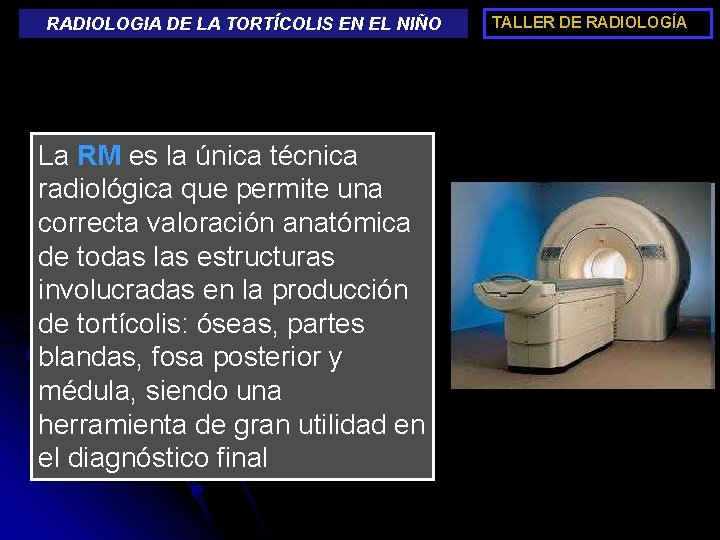 RADIOLOGIA DE LA TORTÍCOLIS EN EL NIÑO La RM es la única técnica radiológica
