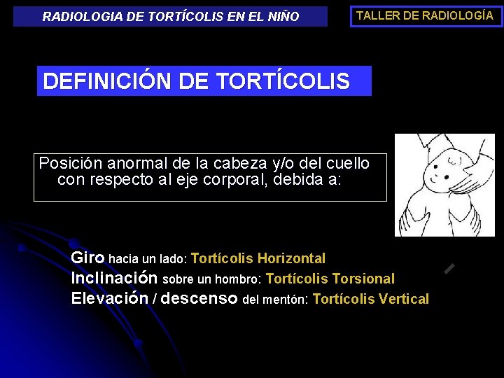 RADIOLOGIA DE TORTÍCOLIS EN EL NIÑO TALLER DE RADIOLOGÍA DEFINICIÓN DE TORTÍCOLIS Posición anormal