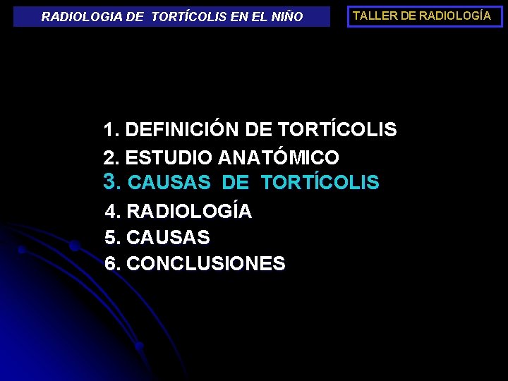 RADIOLOGIA DE TORTÍCOLIS EN EL NIÑO TALLER DE RADIOLOGÍA 1. DEFINICIÓN DE TORTÍCOLIS 2.