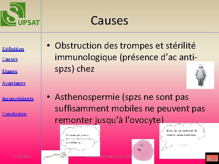 Causes Définition Causes Etapes • Obstruction des trompes et stérilité immunologique (présence d’ac antispzs)