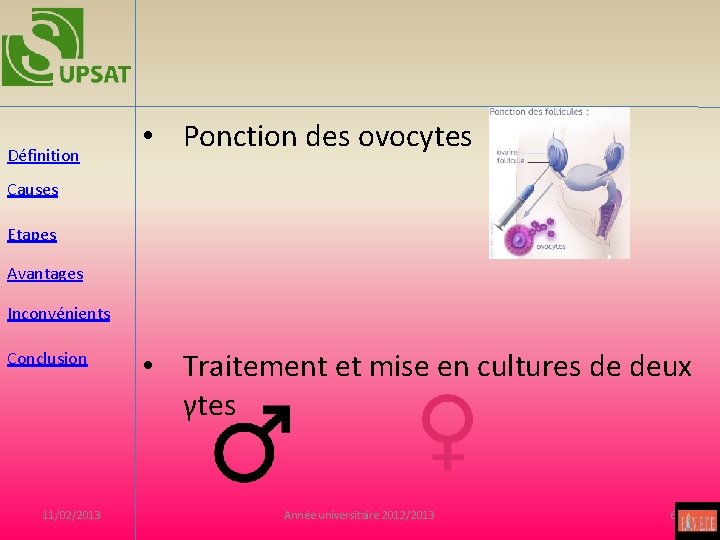 Définition • Ponction des ovocytes Causes Etapes Avantages Inconvénients Conclusion 11/02/2013 • Traitement et