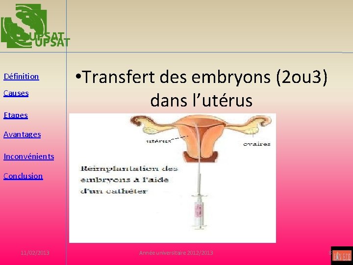 Définition Causes Etapes • Transfert des embryons (2 ou 3) dans l’utérus Avantages Inconvénients