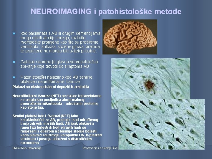 NEUROIMAGING i patohistološke metode l kod pacijenata s AB ili drugim demencijama mogu otkriti