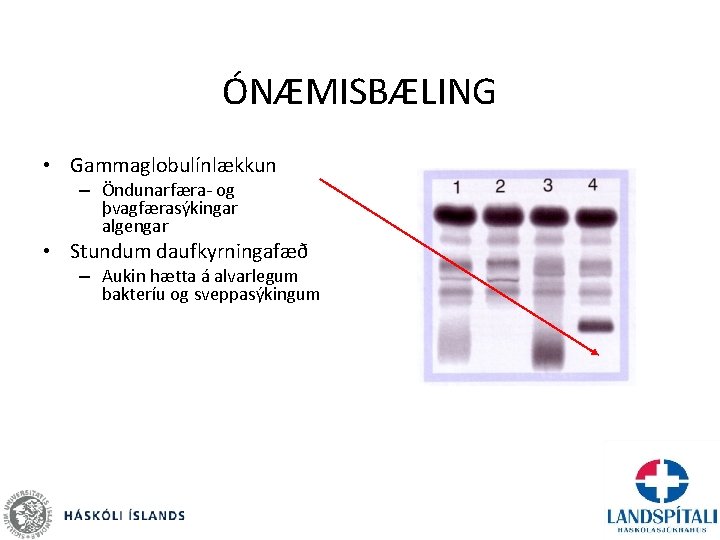 ÓNÆMISBÆLING • Gammaglobulínlækkun – Öndunarfæra- og þvagfærasýkingar algengar • Stundum daufkyrningafæð – Aukin hætta