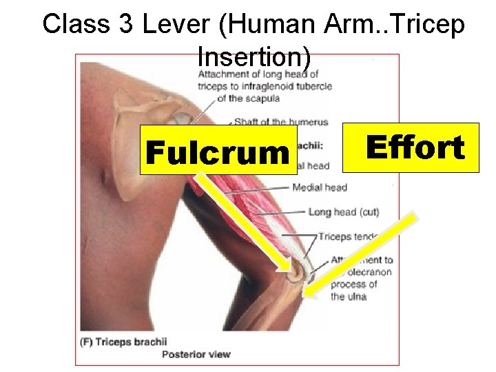 Class 3 Lever (Human Arm. . Tricep Insertion) Fulcrum Effort 