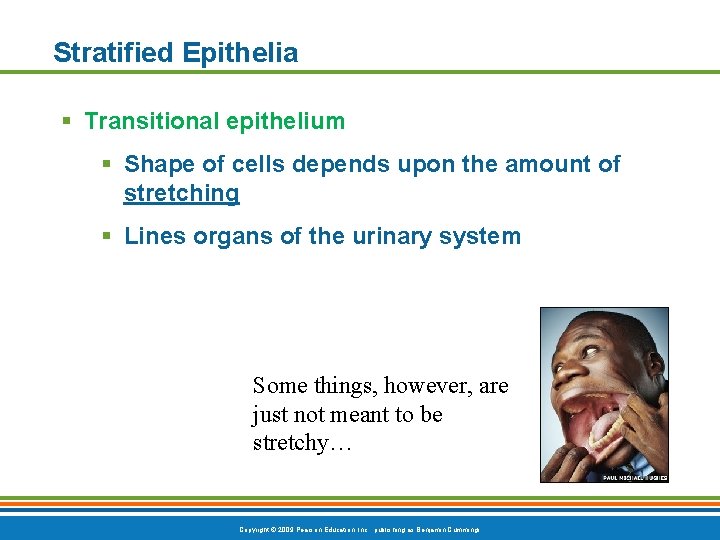 Stratified Epithelia § Transitional epithelium § Shape of cells depends upon the amount of