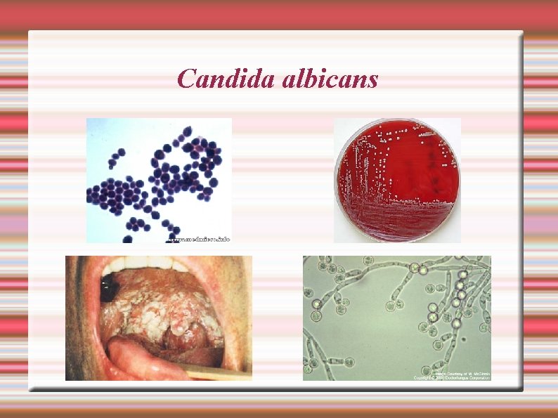 Candida albicans 