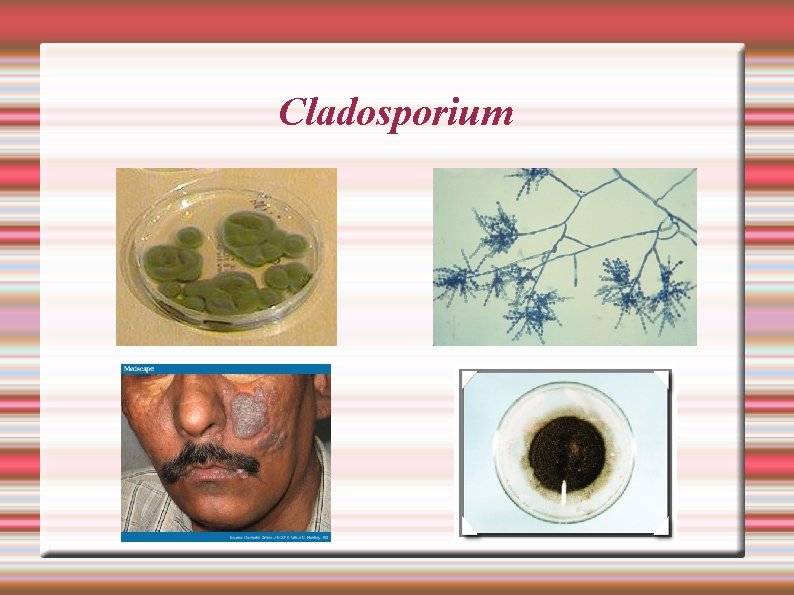 Cladosporium 