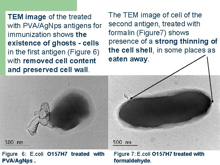 TEM image of the treated with PVA/Ag. Nps antigens for immunization shows the existence