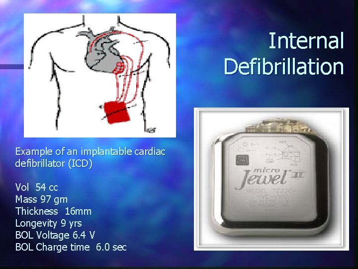 Internal Defibrillation Example of an implantable cardiac defibrillator (ICD) Vol 54 cc Mass 97