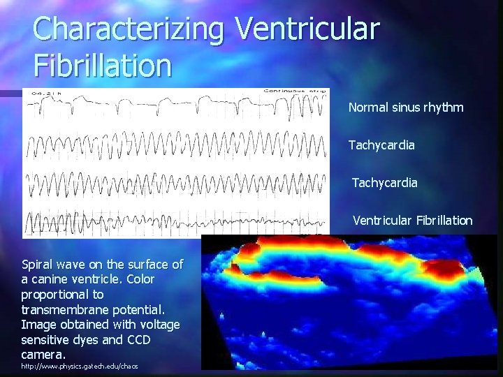 Characterizing Ventricular Fibrillation Normal sinus rhythm Tachycardia Ventricular Fibrillation Spiral wave on the surface