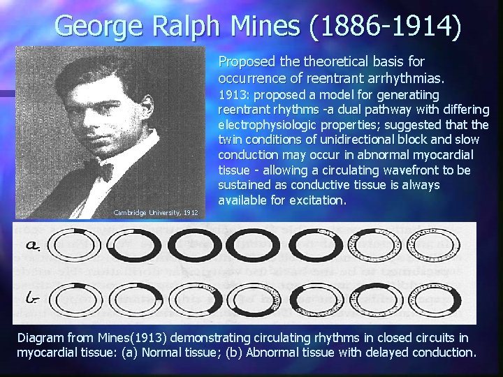 George Ralph Mines (1886 -1914) Proposed theoretical basis for occurrence of reentrant arrhythmias. 1913: