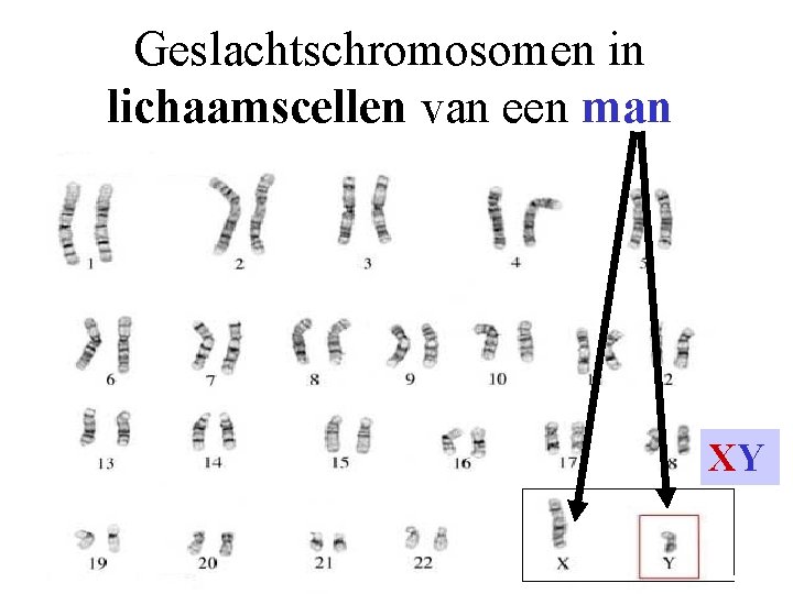 Geslachtschromosomen in lichaamscellen van een man XY 