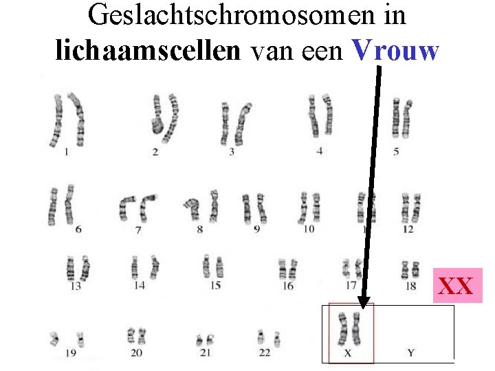 Geslachtschromosomen in lichaamscellen van een Vrouw XX 