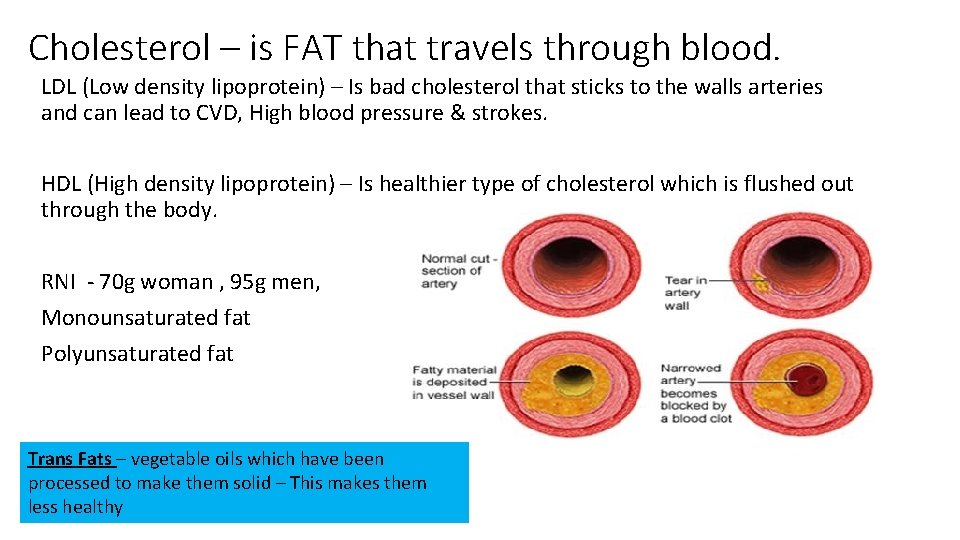 Cholesterol – is FAT that travels through blood. LDL (Low density lipoprotein) – Is