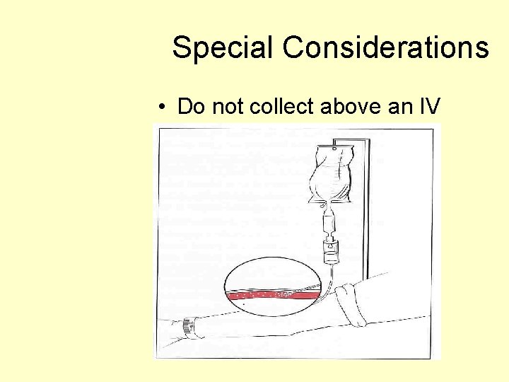 Special Considerations • Do not collect above an IV 