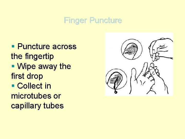 Finger Puncture § Puncture across the fingertip § Wipe away the first drop §