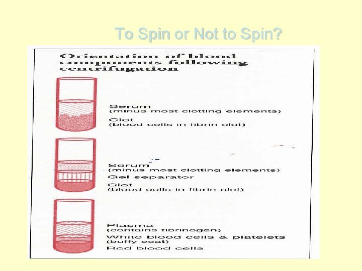 To Spin or Not to Spin? 