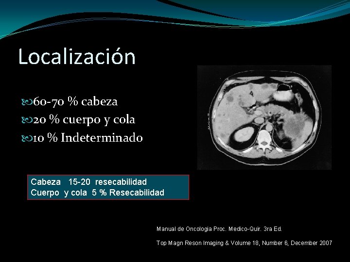 Localización 60 -70 % cabeza 20 % cuerpo y cola 10 % Indeterminado Cabeza