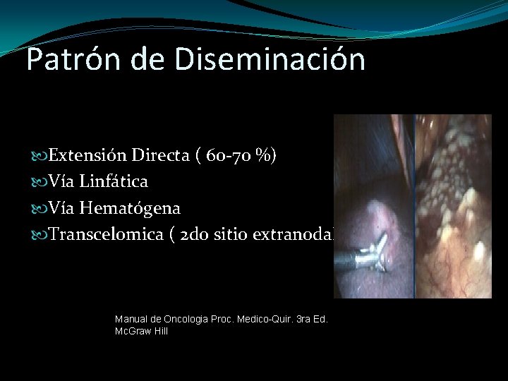 Patrón de Diseminación Extensión Directa ( 60 -70 %) Vía Linfática Vía Hematógena Transcelomica