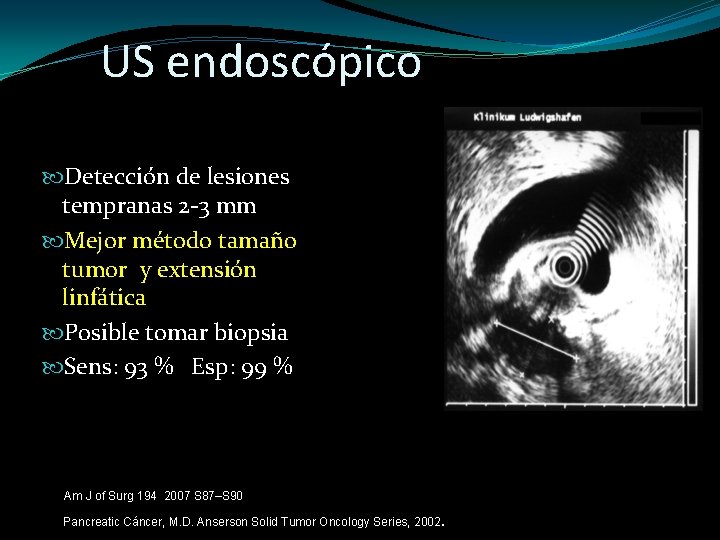 US endoscópico Detección de lesiones tempranas 2 -3 mm Mejor método tamaño tumor y