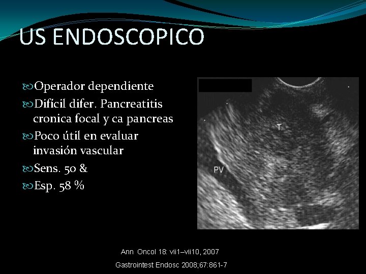 US ENDOSCOPICO Operador dependiente Difícil difer. Pancreatitis cronica focal y ca pancreas Poco útil