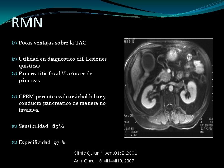 RMN Pocas ventajas sobre la TAC Utilidad en diagnostico dif. Lesiones quisticas Pancreatitis focal