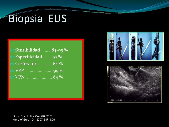 Biopsia EUS Sensibilidad ……. . 84 -95 % Especificidad …. … 97 % Certeza