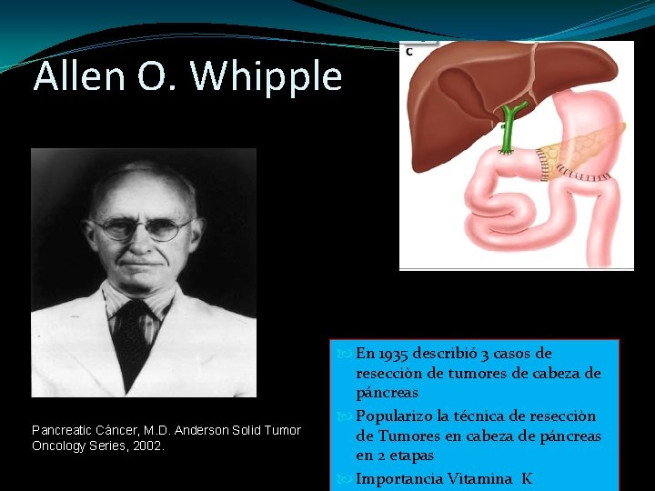 Allen O. Whipple Pancreatic Cáncer, M. D. Anderson Solid Tumor Oncology Series, 2002. En