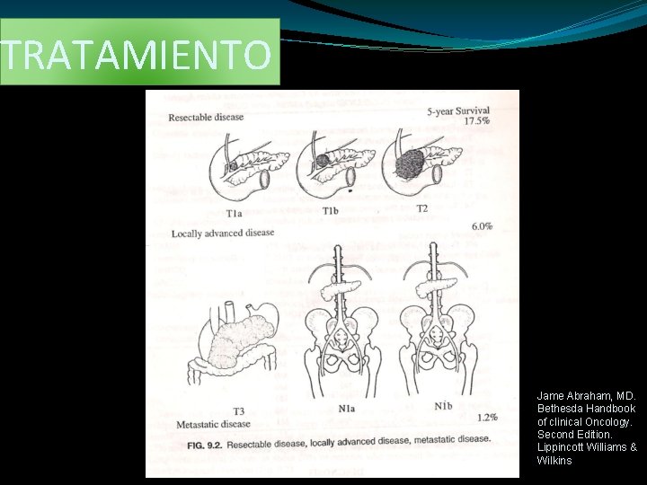 TRATAMIENTO Jame Abraham, MD. Bethesda Handbook of clinical Oncology. Second Edition. Lippincott Williams &