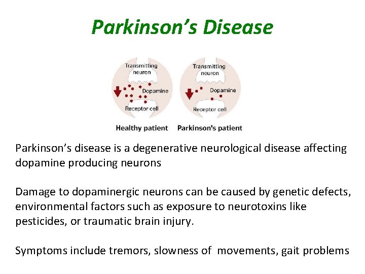 Parkinson’s Disease Parkinson’s disease is a degenerative neurological disease affecting dopamine producing neurons Damage