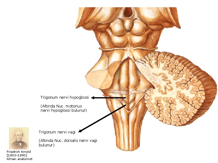 Trigonum nervi hypoglossi (Altında Nuc. motorius nervi hypoglossi bulunur) Trigonum nervi vagi (Altında Nuc.