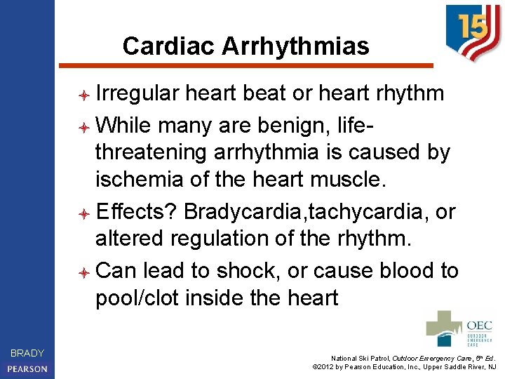 Cardiac Arrhythmias l Irregular heart beat or heart rhythm l While many are benign,