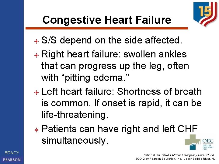 Congestive Heart Failure l S/S depend on the side affected. l Right heart failure: