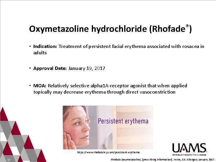 Oxymetazoline hydrochloride (Rhofade®) • Indication: Treatment of persistent facial erythema associated with rosacea in