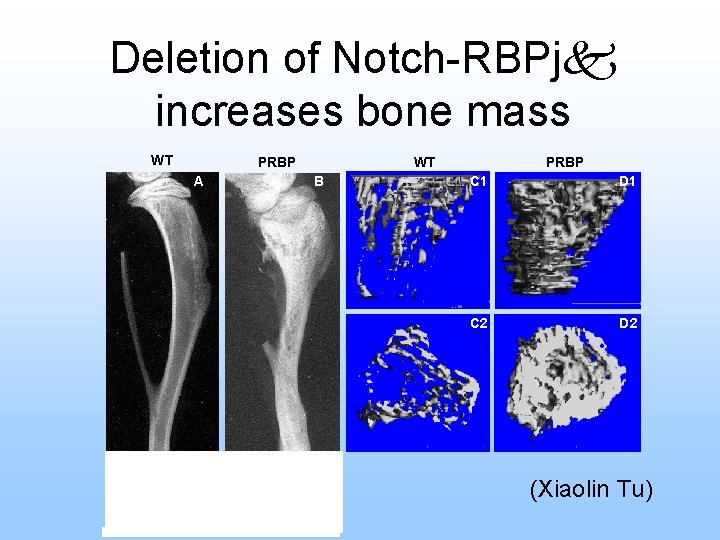 Deletion of Notch-RBPj increases bone mass WT PRBP A WT B PRBP C 1