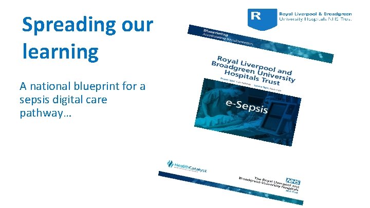 Spreading our learning A national blueprint for a sepsis digital care pathway… 