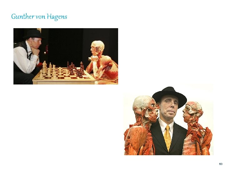  Gunther von Hagens 83 