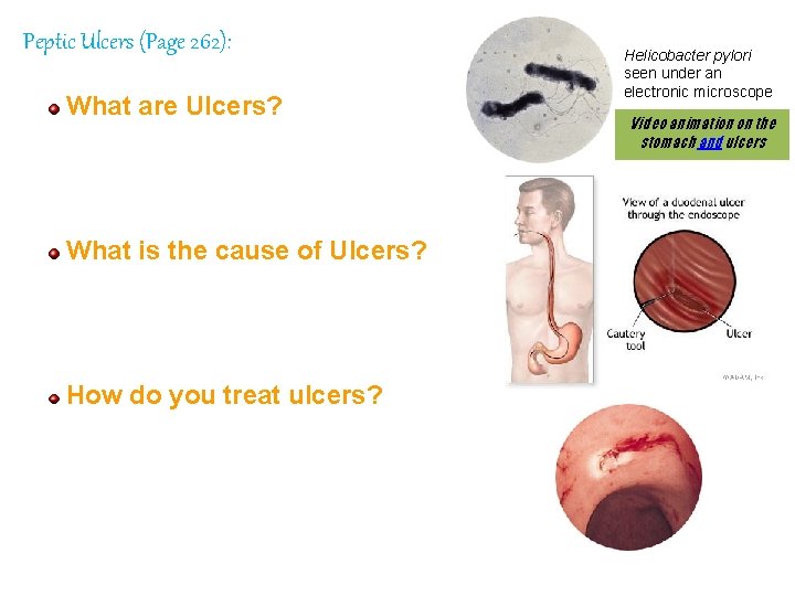 Peptic Ulcers (Page 262): What are Ulcers? Helicobacter pylori seen under an electronic microscope
