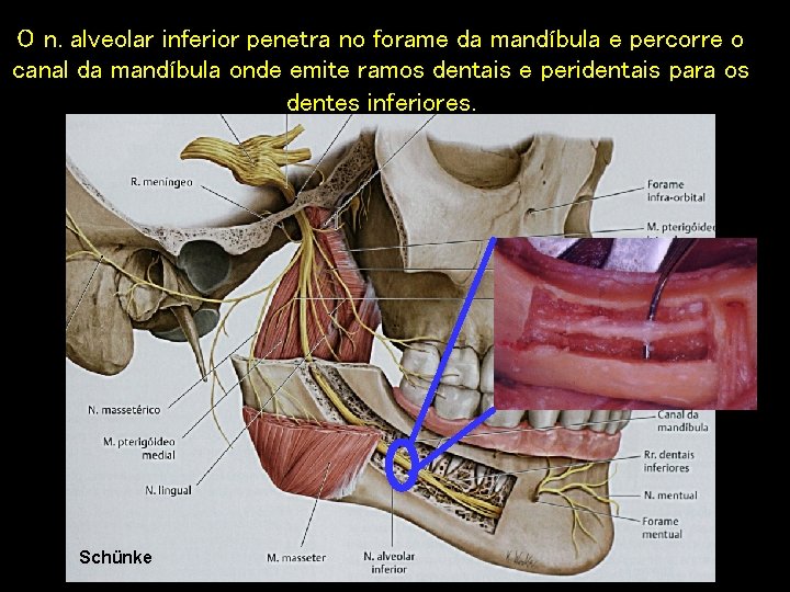 O n. alveolar inferior penetra no forame da mandíbula e percorre o canal da