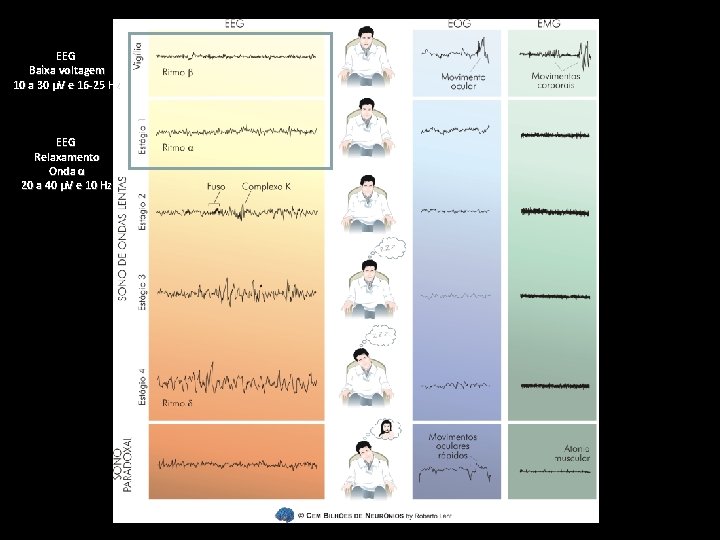 EEG Baixa voltagem 10 a 30 µV e 16 -25 Hz EEG Relaxamento Onda