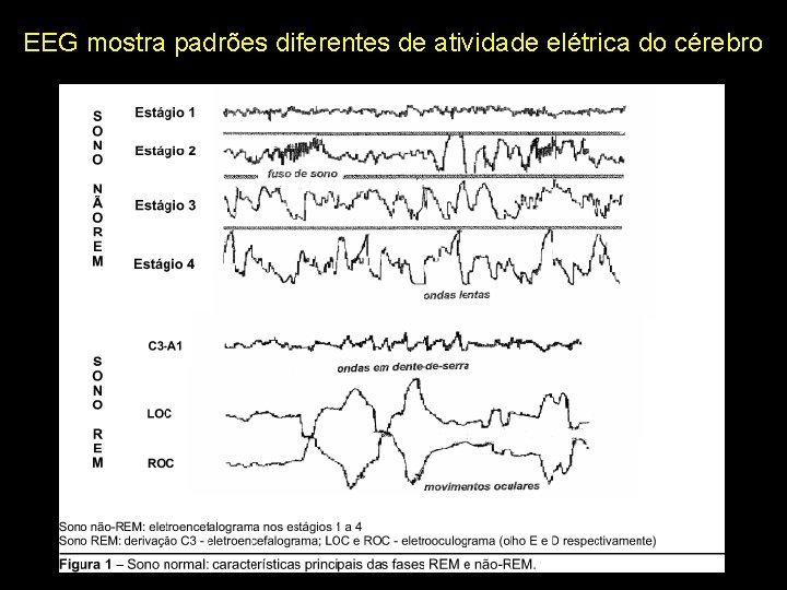 EEG mostra padrões diferentes de atividade elétrica do cérebro 