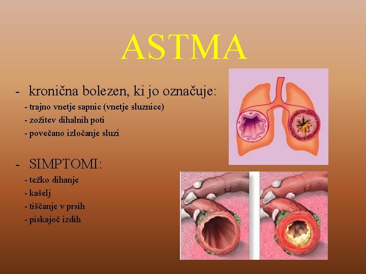 ASTMA - kronična bolezen, ki jo označuje: - trajno vnetje sapnic (vnetje sluznice) -