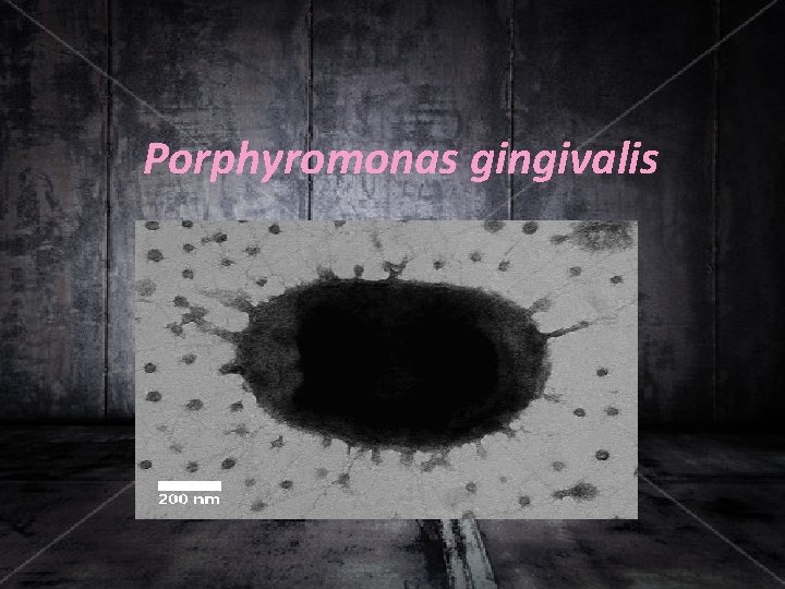 Porphyromonas gingivalis 