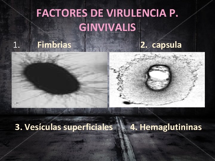 FACTORES DE VIRULENCIA P. GINVIVALIS 1. Fimbrias 3. Vesículas superficiales 2. capsula 4. Hemaglutininas