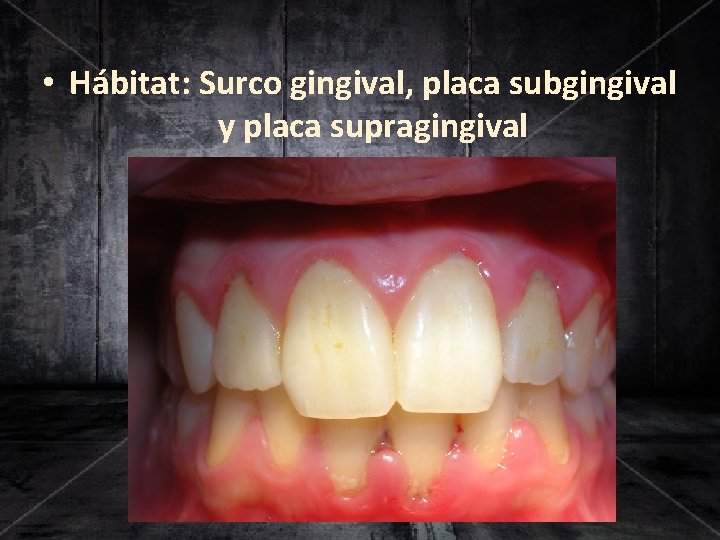  • Hábitat: Surco gingival, placa subgingival y placa supragingival 